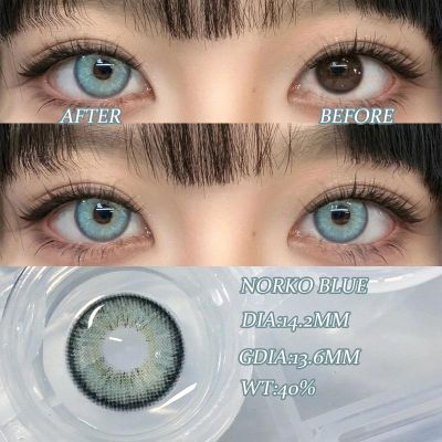 Norko Blue lens set